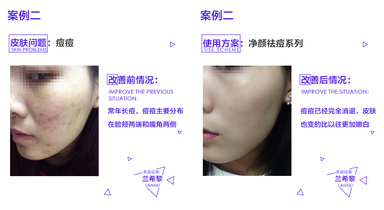 兰希黎：肌不辜负春夏交接好时光