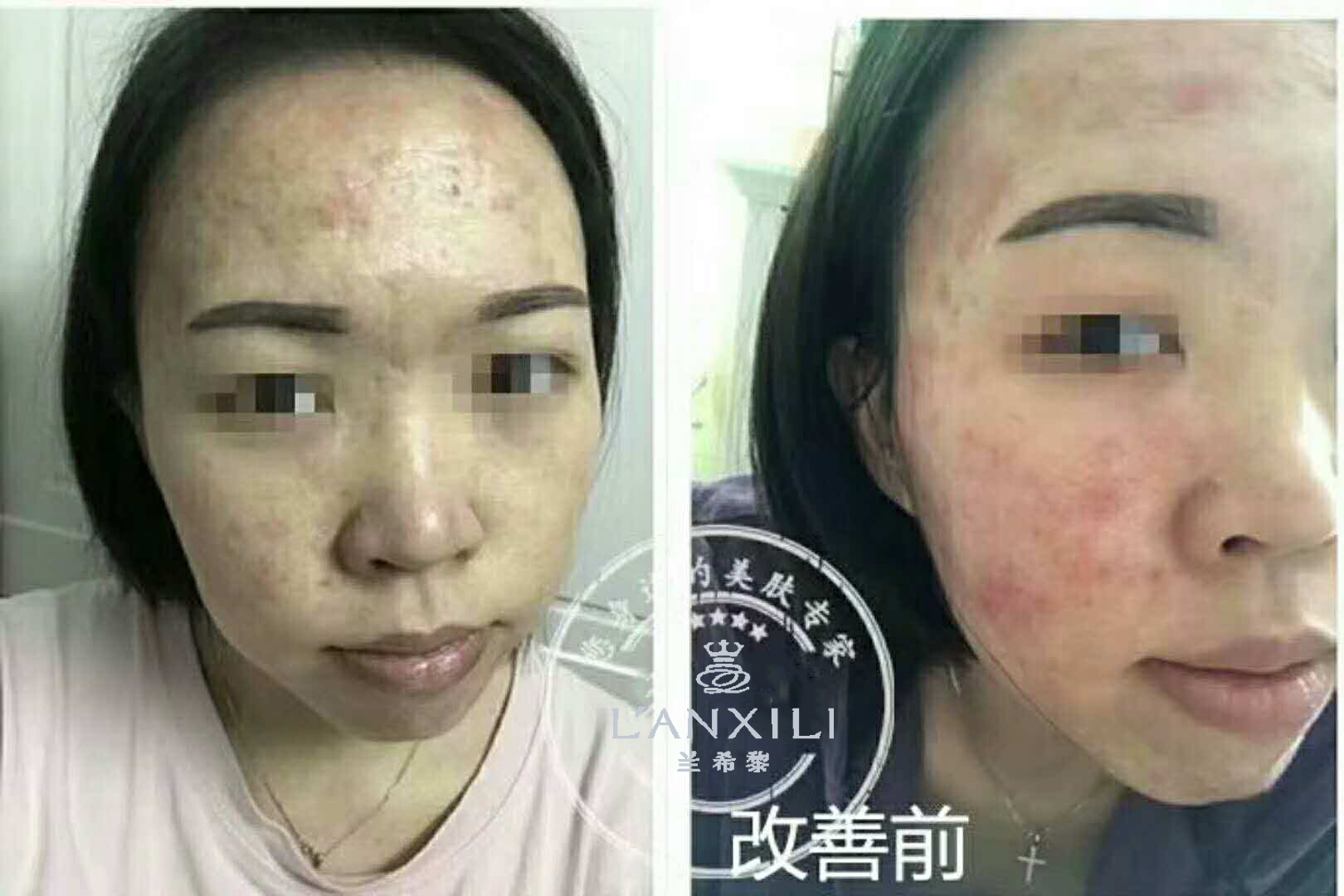 兰希黎线下面诊不靠谱？