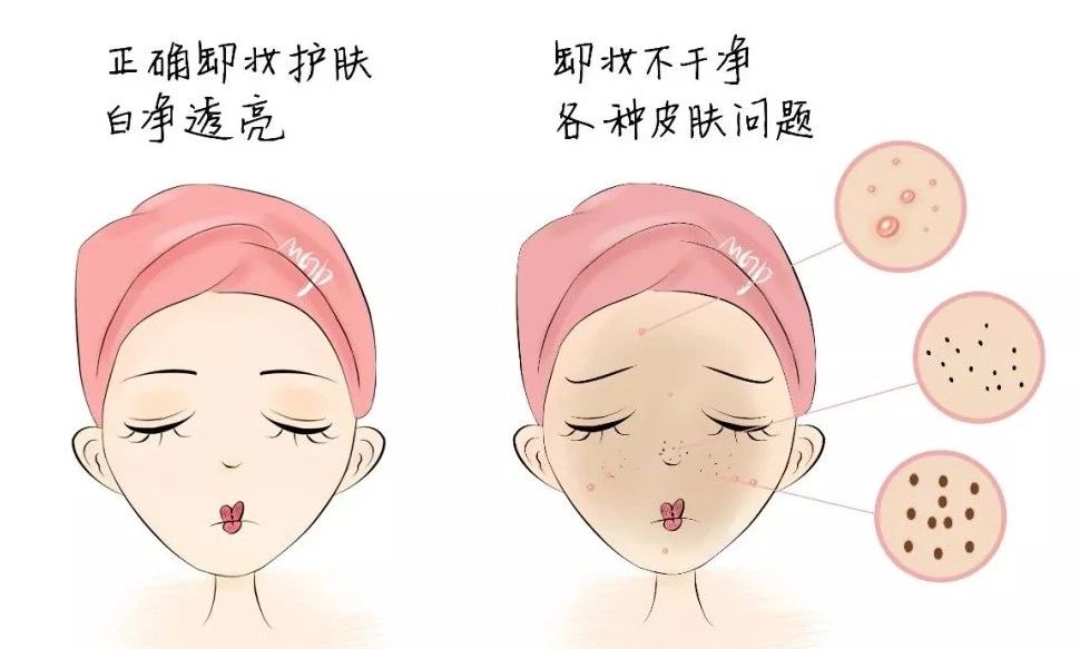 卸妆不对，皮肤差？化妆品：“我可不背锅！”