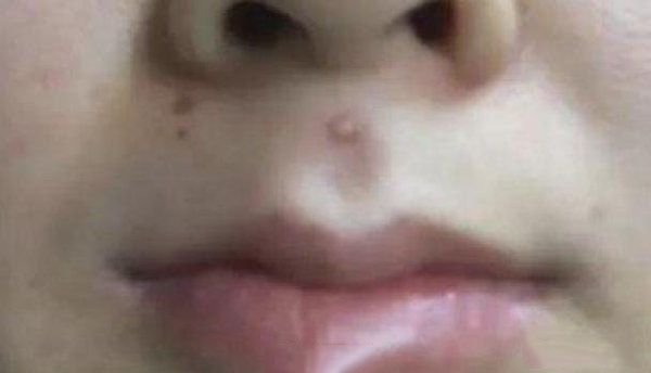 4d551f1a475f4d8495cac63c46c0aa20.jpeg